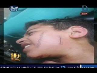 بالفيديو.. تفاصيل اعتداء طالب على زميله وتشويه وجهه بـ 31 غرزة في الفيوم
